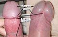 800px-Penis glans anterior posterior (labelled).JPG